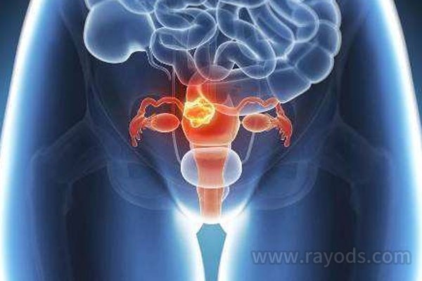 排卵期前的症状有哪些排卵期腹痛是怎么回事
