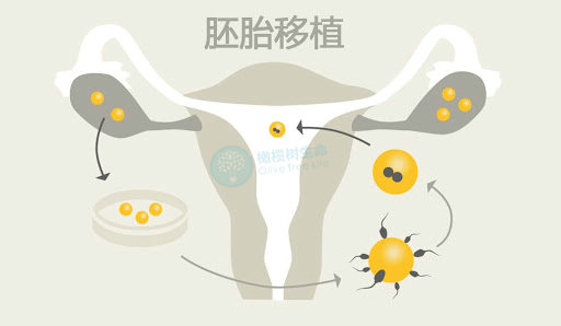 试管婴儿移植成功率与孕酮指标的关系。