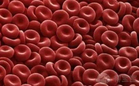 慢性溶血性贫血的症状是什么，要注意什么？